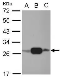 Anti-Adenylate kinase 4 antibody [N1C3-2] used in Western Blot (WB). GTX107482