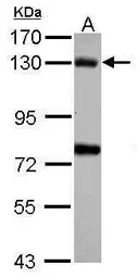 Anti-BUB1 antibody used in Western Blot (WB). GTX107497
