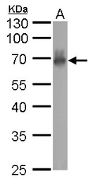 Anti-CaMKI gamma antibody used in Western Blot (WB). GTX107499
