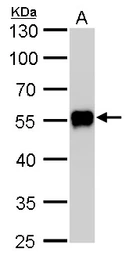 Anti-CaMKI gamma antibody used in Western Blot (WB). GTX107499