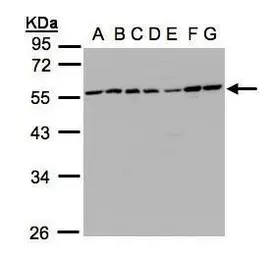Anti-CaMKI gamma antibody used in Western Blot (WB). GTX107499