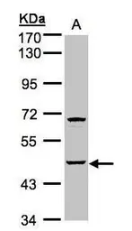 Anti-SPHK1 antibody used in Western Blot (WB). GTX107509