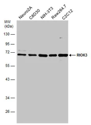 Anti-RIOK3 antibody used in Western Blot (WB). GTX107514
