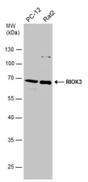 Anti-RIOK3 antibody used in Western Blot (WB). GTX107514