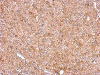 Anti-RIOK3 antibody used in IHC (Paraffin sections) (IHC-P). GTX107514