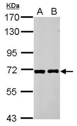 Anti-RIOK3 antibody used in Western Blot (WB). GTX107514