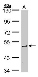 Anti-CaMKIV antibody used in Western Blot (WB). GTX107515
