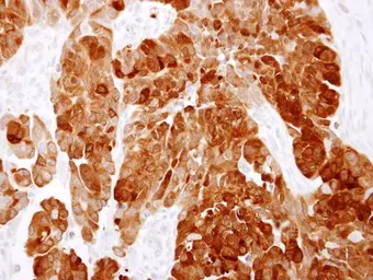 Anti-CCDC6 antibody used in IHC (Paraffin sections) (IHC-P). GTX107522