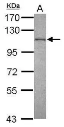 Anti-EXOSC10 antibody used in Western Blot (WB). GTX107524