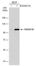 Anti-EXOSC10 antibody used in Western Blot (WB). GTX107524