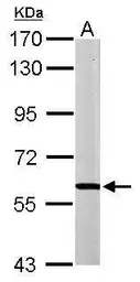Anti-MPP2 antibody [N1C1] used in Western Blot (WB). GTX107528