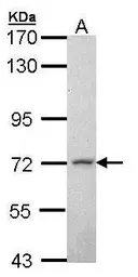 Anti-MPP2 antibody [N1C1] used in Western Blot (WB). GTX107528