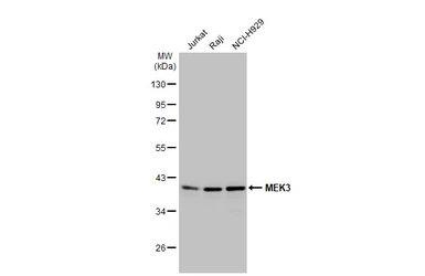 Anti-MEK3 antibody [N1C3] used in Western Blot (WB). GTX107529
