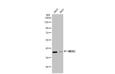 Anti-MEK3 antibody [N1C3] used in Western Blot (WB). GTX107529