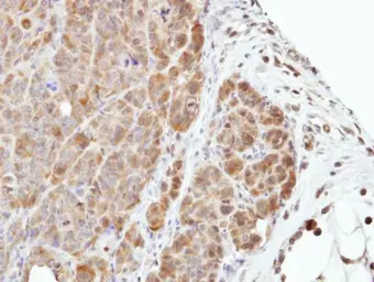 Anti-MEK3 antibody [N1C3] used in IHC (Paraffin sections) (IHC-P). GTX107529