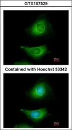 Anti-MEK3 antibody [N1C3] used in Immunocytochemistry/ Immunofluorescence (ICC/IF). GTX107529