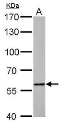 Anti-Pyruvate Kinase (liver/RBC) antibody used in Western Blot (WB). GTX107546