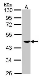 Anti-CKMT2 antibody [N1C1] used in Western Blot (WB). GTX107547