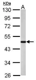 Anti-YANK2 antibody [N1C1-2] used in Western Blot (WB). GTX107555