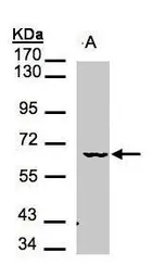 Anti-MAK antibody [N1N3] used in Western Blot (WB). GTX107556