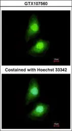 Anti-SKAP55 antibody [N1C3-2] used in Immunocytochemistry/ Immunofluorescence (ICC/IF). GTX107560