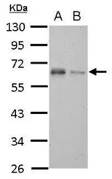Anti-TAB1 antibody used in Western Blot (WB). GTX107571