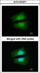 Anti-TAB1 antibody used in Immunocytochemistry/ Immunofluorescence (ICC/IF). GTX107571