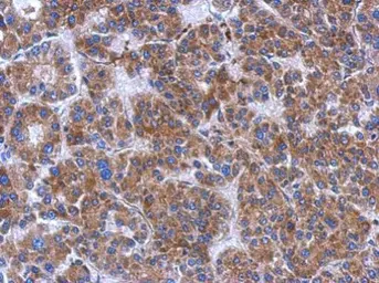 Anti-FN3K antibody [N1C3-2] used in IHC (Paraffin sections) (IHC-P). GTX107579