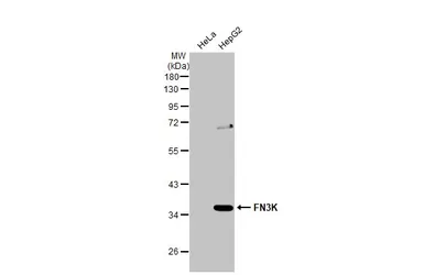 Anti-FN3K antibody [N1C3-2] used in Western Blot (WB). GTX107579