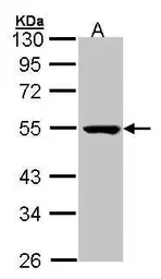 Anti-PSKH1 antibody [N1C1-2] used in Western Blot (WB). GTX107585
