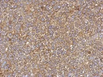 Anti-CSK antibody used in IHC (Paraffin sections) (IHC-P). GTX107602