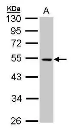 Anti-CSK antibody used in Western Blot (WB). GTX107602