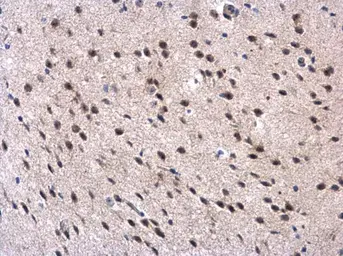 Anti-MPP3 antibody [N1C1] used in IHC (Paraffin sections) (IHC-P). GTX107608