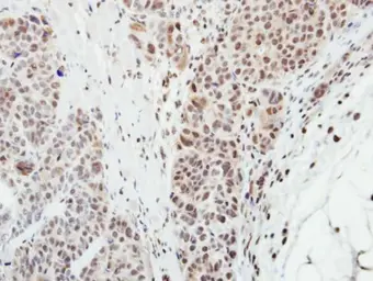 Anti-MPP3 antibody [N1C1] used in IHC (Paraffin sections) (IHC-P). GTX107608