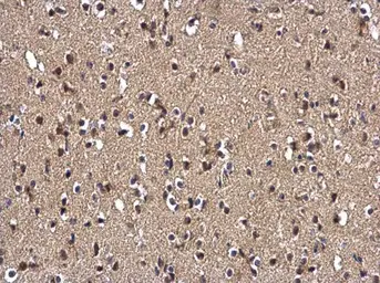 Anti-Selenophosphate synthetase 1 antibody [N1C1-2] used in IHC (Paraffin sections) (IHC-P). GTX107611