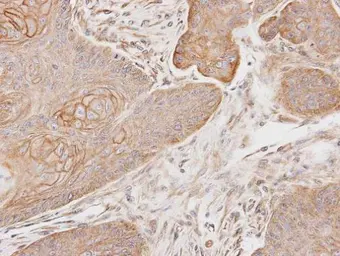Anti-Selenophosphate synthetase 1 antibody [N1C1-2] used in IHC (Paraffin sections) (IHC-P). GTX107611