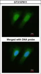Anti-Selenophosphate synthetase 1 antibody [N1C1-2] used in Immunocytochemistry/ Immunofluorescence (ICC/IF). GTX107611