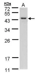 Anti-Selenophosphate synthetase 1 antibody [N1C1-2] used in Western Blot (WB). GTX107611