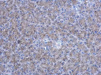 Anti-Adenylate kinase 2 antibody [N1C3] used in IHC (Paraffin sections) (IHC-P). GTX107613