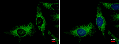Anti-Adenylate kinase 2 antibody [N1C3] used in Immunocytochemistry/ Immunofluorescence (ICC/IF). GTX107613