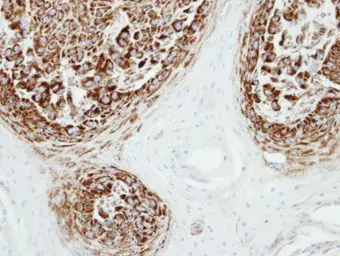 Anti-Adenylate kinase 2 antibody [N1C3] used in IHC (Paraffin sections) (IHC-P). GTX107613