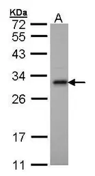 Anti-Adenylate kinase 2 antibody [N1C3] used in Western Blot (WB). GTX107613