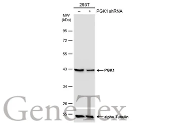 Anti-PGK1 antibody used in Western Blot (WB). GTX107614