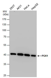 Anti-PGK1 antibody used in Western Blot (WB). GTX107614