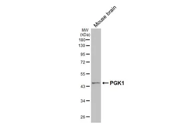 Anti-PGK1 antibody used in Western Blot (WB). GTX107614