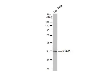 Anti-PGK1 antibody used in Western Blot (WB). GTX107614