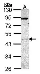 Anti-PRAK antibody used in Western Blot (WB). GTX107628