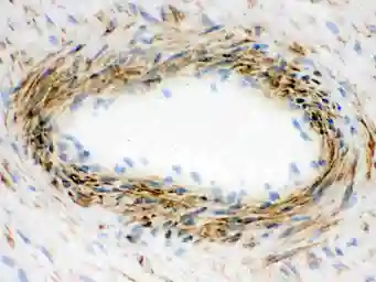 Anti-Actin antibody [AC-40] used in IHC (Frozen sections) (IHC-Fr). GTX10763