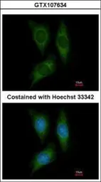 Anti-STK25 antibody [N1C1] used in Immunocytochemistry/ Immunofluorescence (ICC/IF). GTX107634