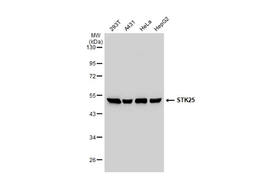 Anti-STK25 antibody [N1C1] used in Western Blot (WB). GTX107634